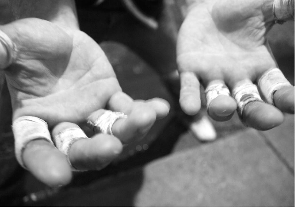 Black-and-white close view of hands marked by physical work.
